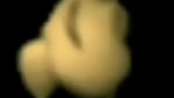 Xvideos 315