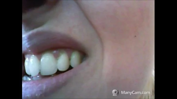 Such A Beautiful Woman Should Not Have Such Neglected Teeth